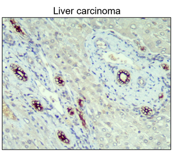 Cytokeratin 14 Rabbit Polyclonal Antibody