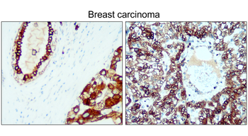Cytokeratin 8 Rabbit Polyclonal Antibody