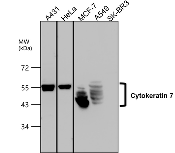 Cytokeratin 7 Rabbit Polyclonal Antibody