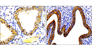 Cytokeratin 7 Rabbit Polyclonal Antibody