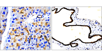Cytokeratin 7 Rabbit Polyclonal Antibody