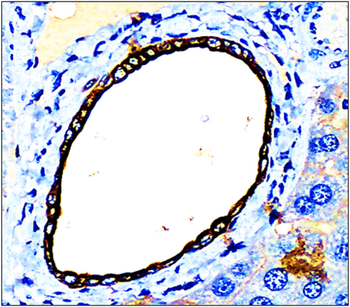 Cytokeratin 7 Rabbit Polyclonal Antibody