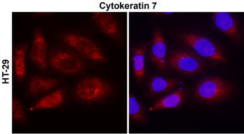 Cytokeratin 7 Rabbit Polyclonal Antibody