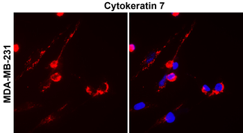 Cytokeratin 7 Rabbit Polyclonal Antibody