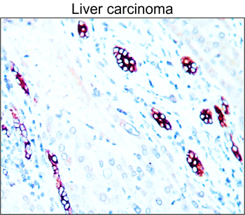 Cytokeratin 7 Rabbit Polyclonal Antibody