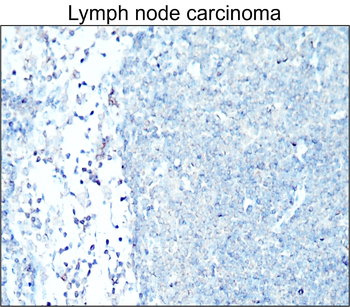 Cytokeratin 7 Rabbit Polyclonal Antibody