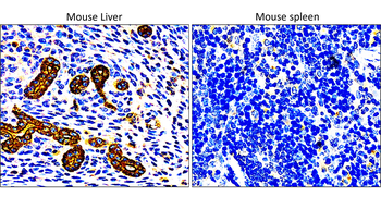 Cytokeratin 7 Rabbit Polyclonal Antibody