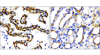 Cytokeratin 7 Rabbit Polyclonal Antibody