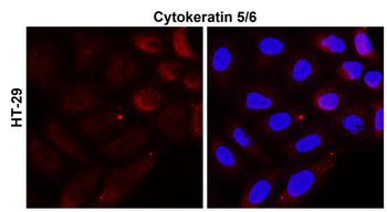 Cytokeratin 5 Rabbit Polyclonal Antibody