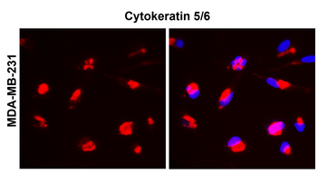 Cytokeratin 5 Rabbit Polyclonal Antibody
