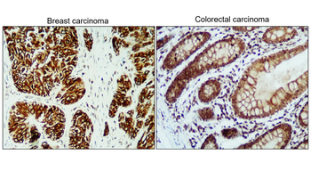 Cytokeratin 5 Rabbit Polyclonal Antibody