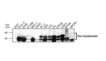 Pan-Cytokeratin Rabbit Polyclonal Antibody