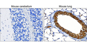 Pan-Cytokeratin Rabbit Polyclonal Antibody