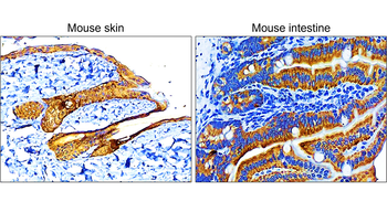 Pan-Cytokeratin Rabbit Polyclonal Antibody