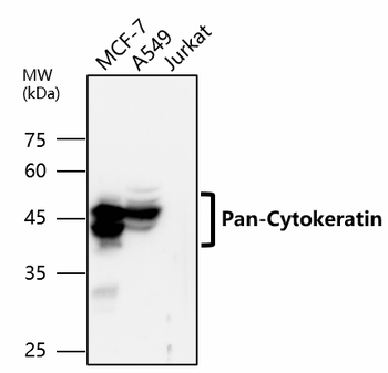 Pan-Cytokeratin Rabbit Polyclonal Antibody