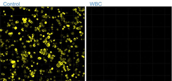 Pan-Cytokeratin Rabbit Polyclonal Antibody