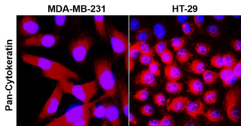 Pan-Cytokeratin Rabbit Polyclonal Antibody