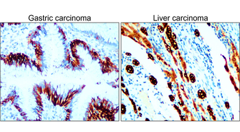 Pan-Cytokeratin Rabbit Polyclonal Antibody