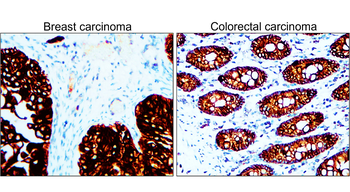 Pan-Cytokeratin Rabbit Polyclonal Antibody