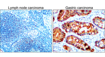 Pan-Cytokeratin Rabbit Polyclonal Antibody