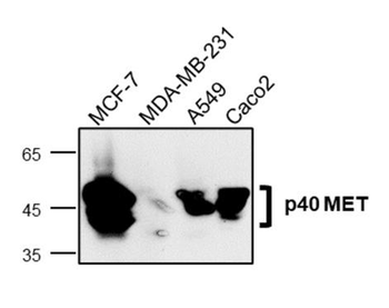 MET Rabbit Polyclonal Antibody