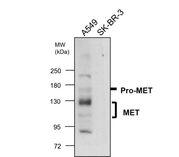 MET Rabbit Polyclonal Antibody