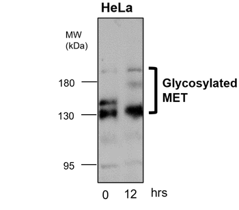 MET Rabbit Polyclonal Antibody