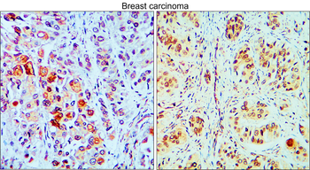 MET Rabbit Polyclonal Antibody