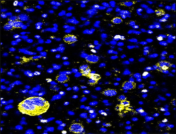 EpCAM Rabbit Polyclonal Antibody
