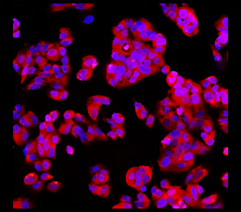 EpCAM Rabbit Polyclonal Antibody