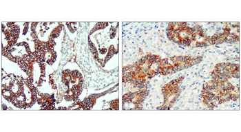 EpCAM Rabbit Polyclonal Antibody