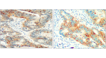 EpCAM Rabbit Polyclonal Antibody