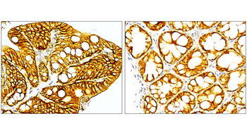 EpCAM Rabbit Polyclonal Antibody
