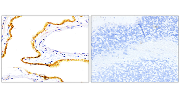 EpCAM Rabbit Polyclonal Antibody