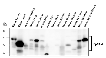 EpCAM Rabbit Polyclonal Antibody