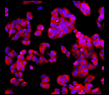 EpCAM Rabbit Polyclonal Antibody