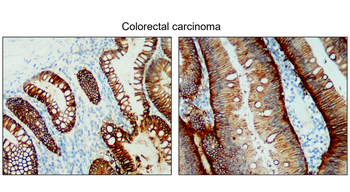 EpCAM Rabbit Polyclonal Antibody