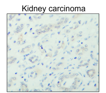 ESR1 Rabbit Polyclonal Antibody