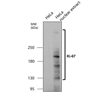 KI-67 Rabbit Polyclonal Antibody