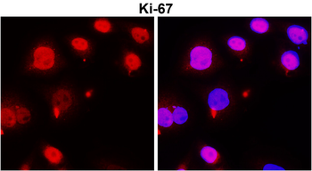 KI-67 Rabbit Polyclonal Antibody