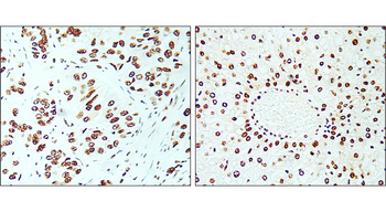 KI-67 Rabbit Polyclonal Antibody