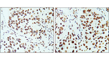 KI-67 Rabbit Polyclonal Antibody