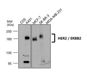 HER2 Rabbit Polyclonal Antibody