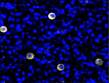 HER2 Rabbit Polyclonal Antibody