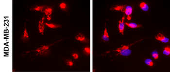 HER2 Rabbit Polyclonal Antibody