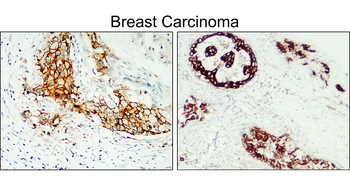 HER2 Rabbit Polyclonal Antibody
