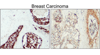 HER2 Rabbit Polyclonal Antibody