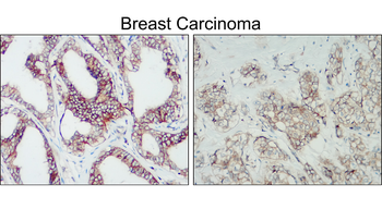 HER2 Rabbit Polyclonal Antibody