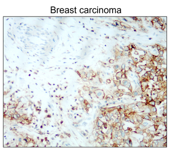 CD44 Rabbit Polyclonal Antibody
