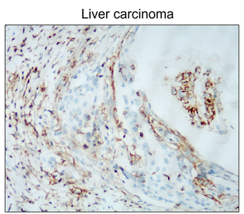 CD44 Rabbit Polyclonal Antibody